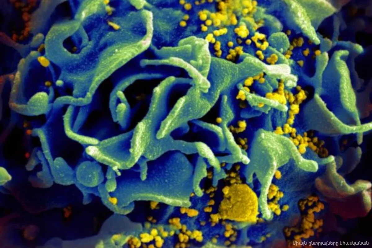 В Осло зафиксирован десятый случай излечения от ВИЧ: пациенту помогла редкая мутация брата